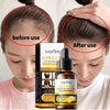 Sadoer ginger anti hair loss and irritation hair growth hair oil