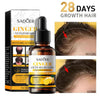 Sadoer ginger anti hair loss and irritation hair growth hair oil