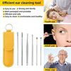 6-Piece Ear Wax Removal Kit – Stainless Steel Ear Pick Tool Set for Safe Cleaning