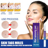 Wart & Verruca Removal Pen – Fast Acting Liquid Treatment for Clear, Healthy Skin