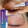 Wart & Verruca Removal Pen – Fast Acting Liquid Treatment for Clear, Healthy Skin