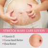 Natural Pregnancy Moisturizing Cream – Anti Stretch Marks & Scar Removal, Smooth Hydrating Body Lotion (200ml)